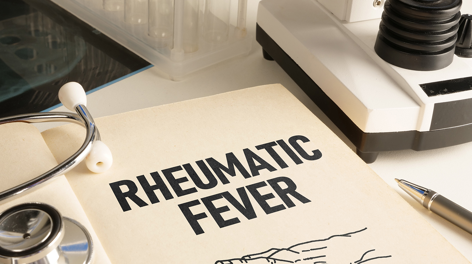 Rheumatic Fever is shown as medical concept
